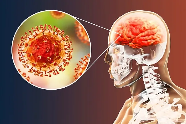 Pakar: Virus Nipah Termasuk Patogen Paling Berbahaya, Indonesia Jangan Menunggu Korban (Ilustrasi)