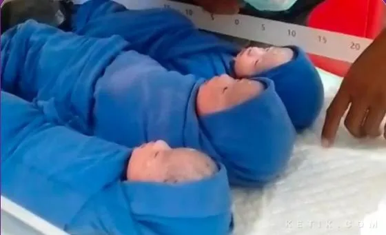 Kisah Pasutri di Bangkalan, Dari Kaget hingga Bahagia Sambut Anak Kembar Tiga (Ilustrasi)